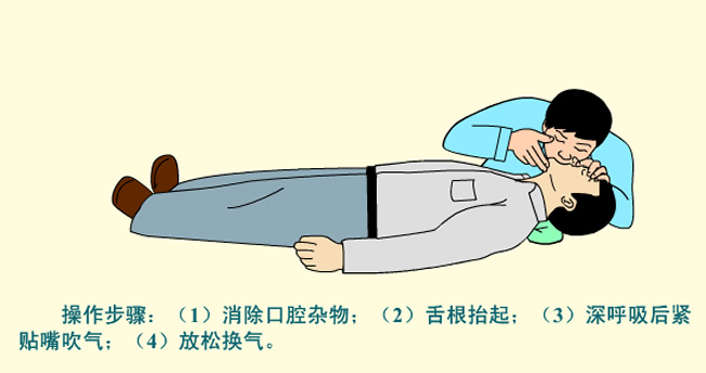口對(duì)口人工呼吸法 口對(duì)口人工呼吸法